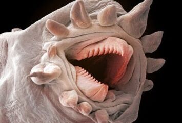 Que vermes poden vivir no corpo humano