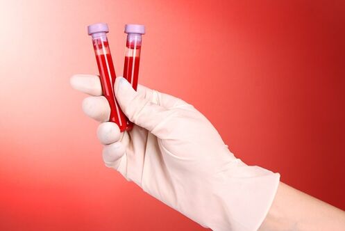 Análise de sangue para parasitos