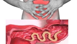 Síntomas da presenza de parasitos no intestino humano
