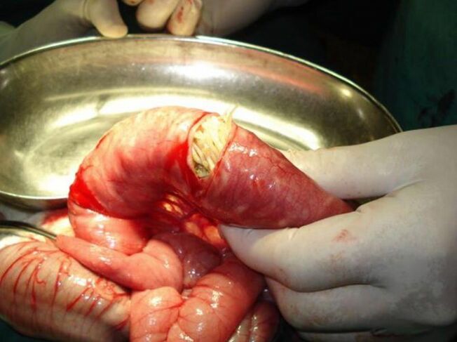 Estes parasitos son perigosos para os humanos